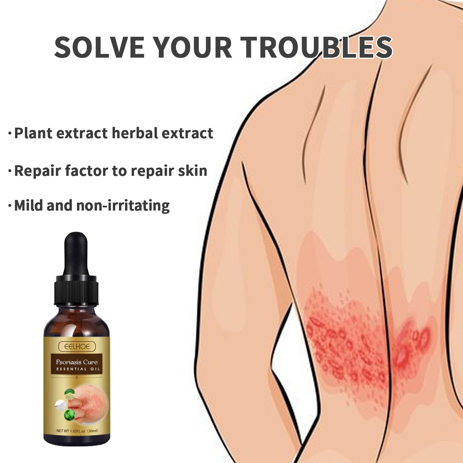 Skin Moss Repair Essential Oil Relieves Itching